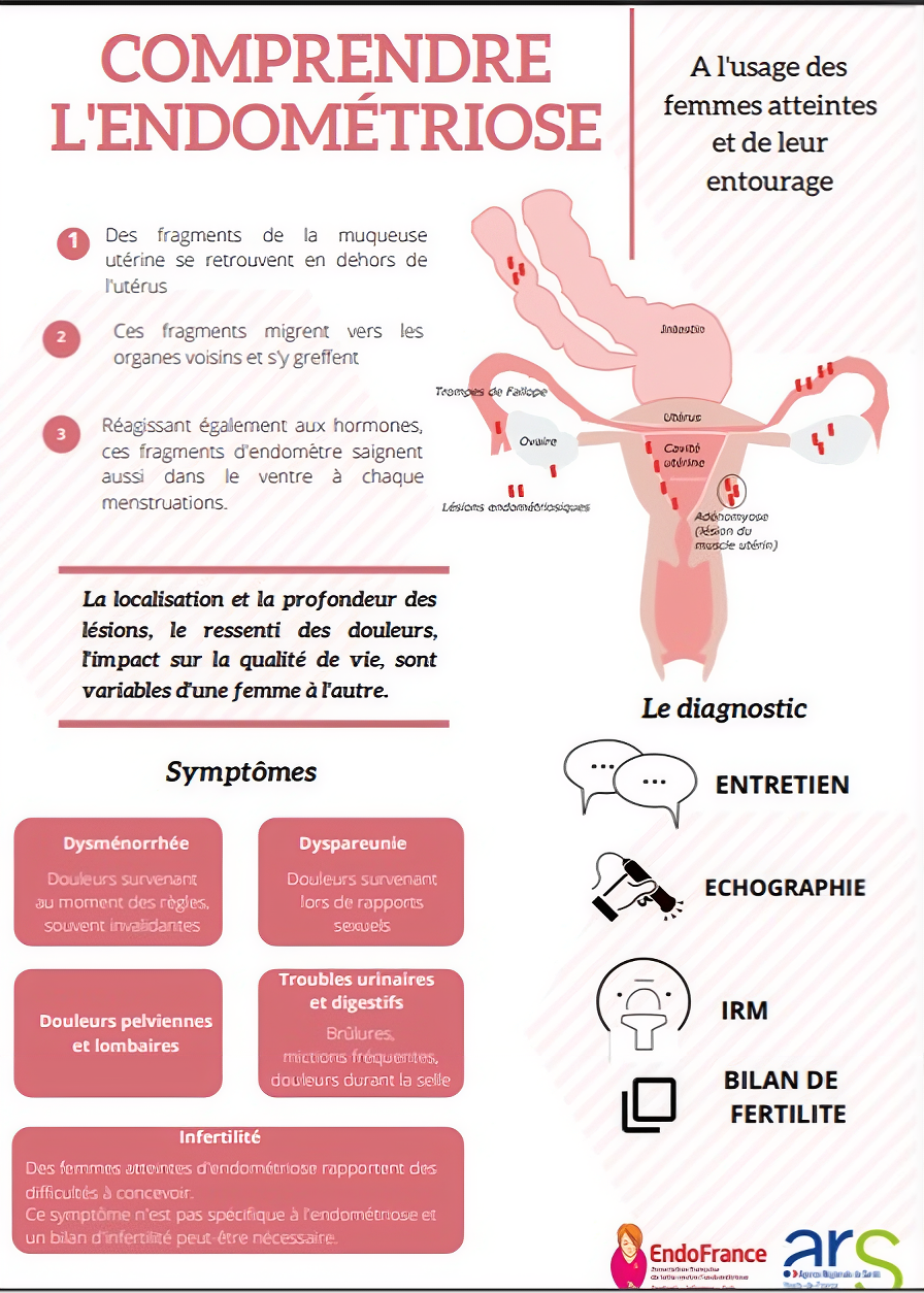 comprendre endometriose
